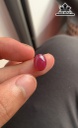 Viên Đá Ruby Yên Bái 5,6cts